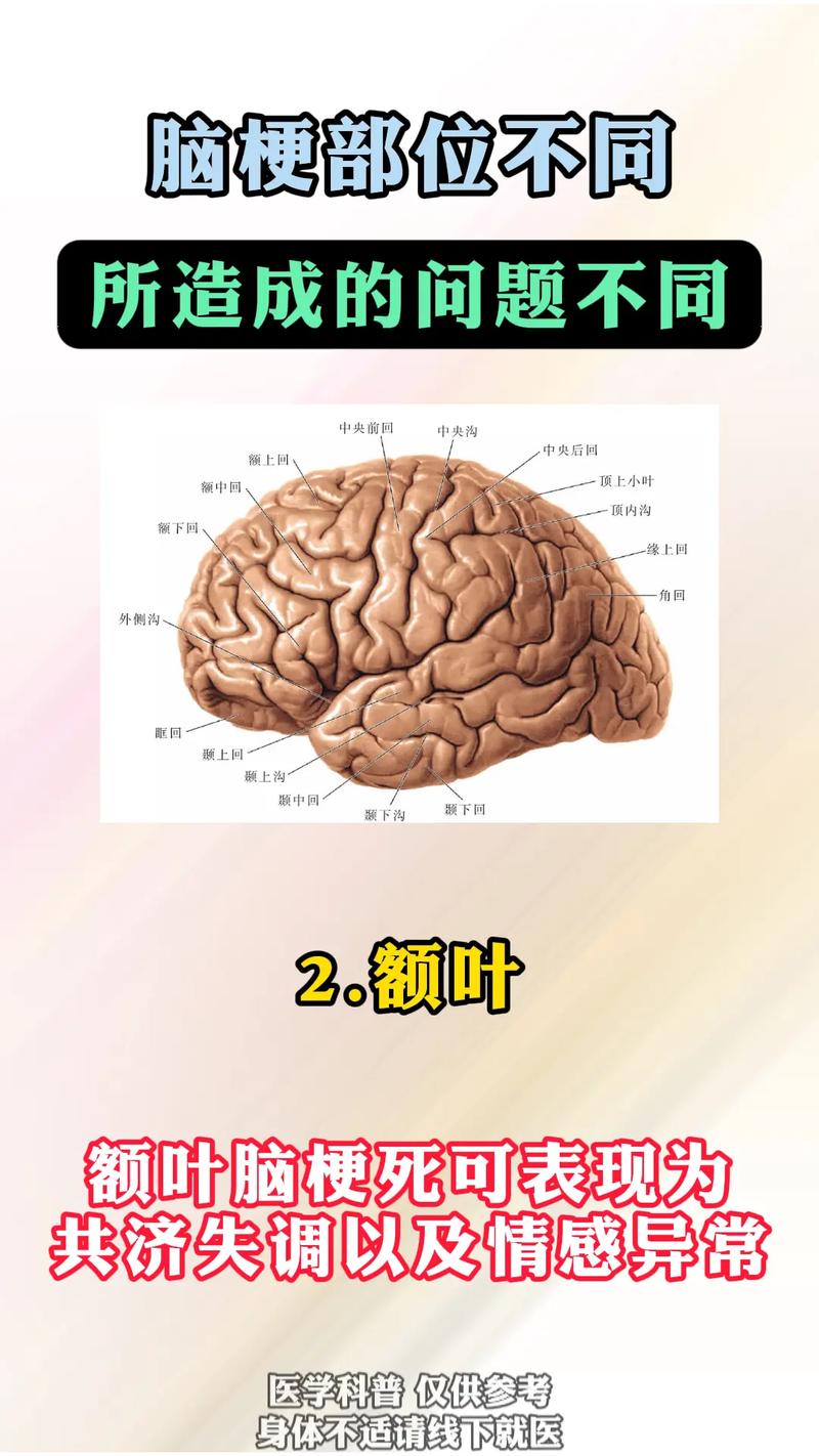 脑梗和脑梗塞有何区别