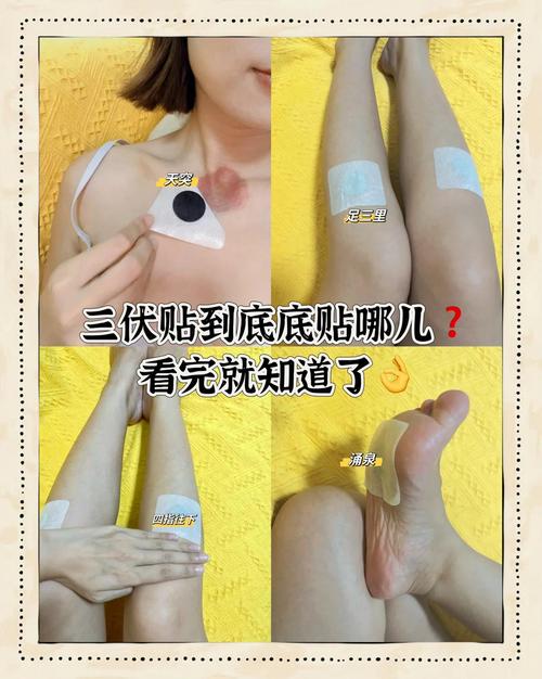 修正穴位贴敷贴哪里