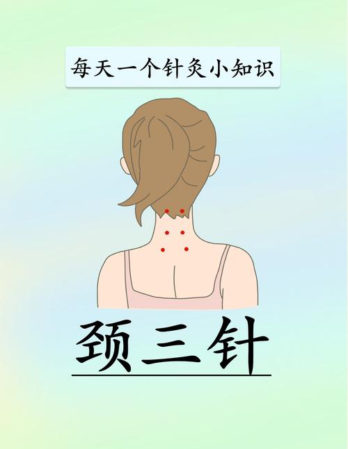 颈部的针灸穴位注意
