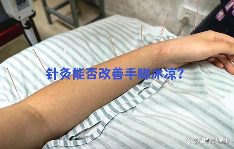 手脚凉针灸什么穴位