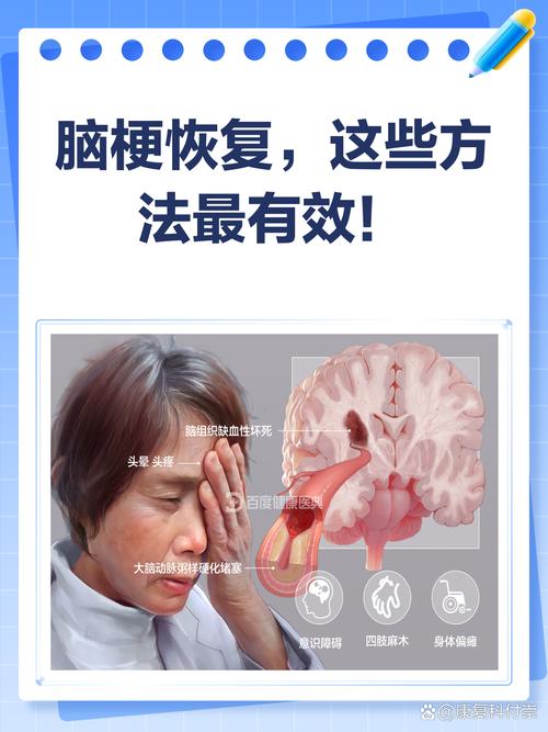 脑梗不会说话多久恢复