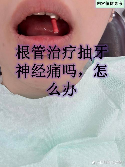 脑梗的病人能不能拔牙