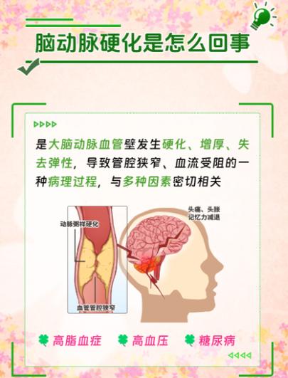 脑梗出虚汗是怎么回事
