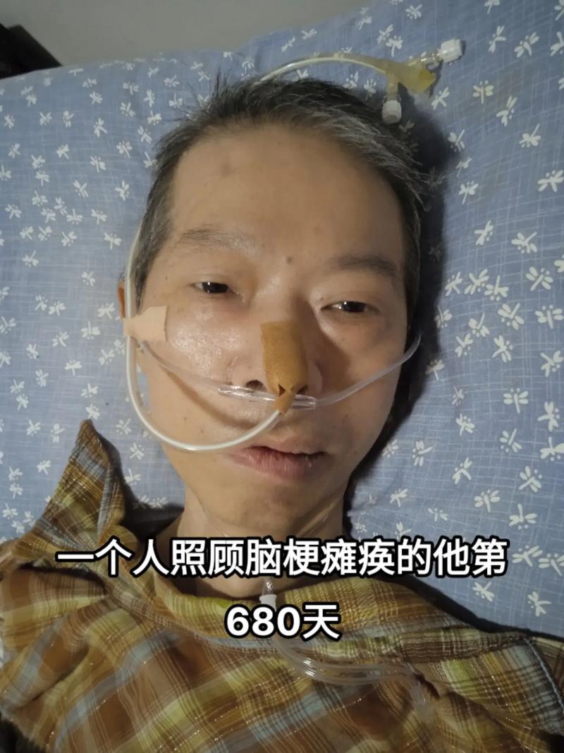 大面积脑梗水肿期多久