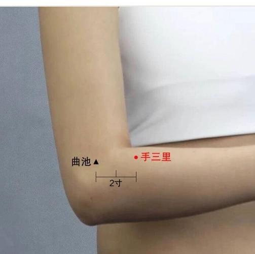 手臂痛针灸什么穴位