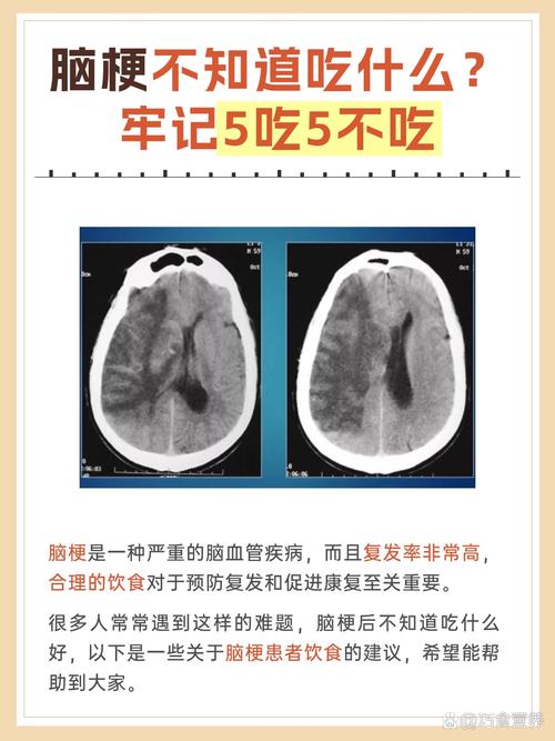 有脑梗不能吃什么食物