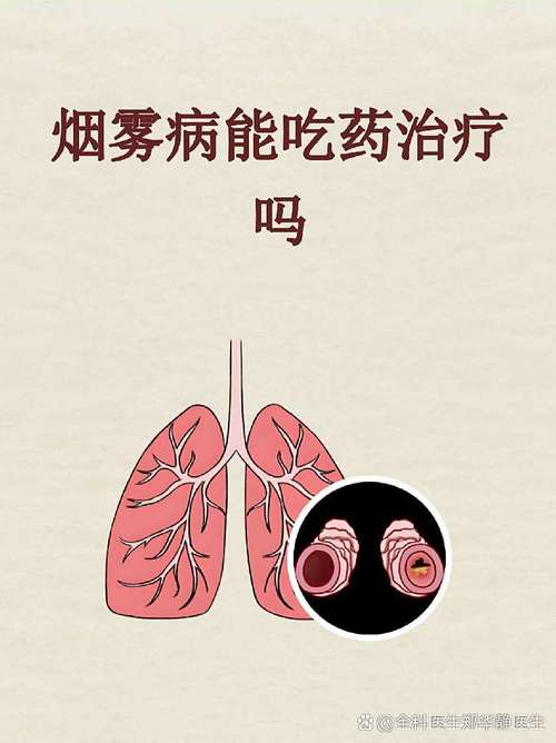 烟雾病引起脑梗好治吗