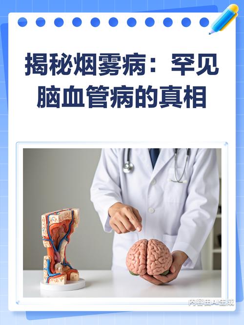 烟雾病引起脑梗好治吗