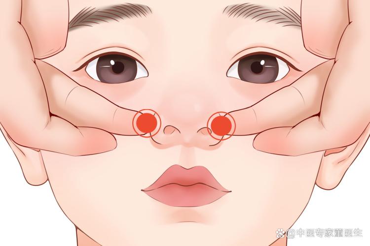 女性流鼻血按摩穴位