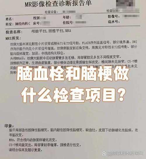 怀疑脑梗要做什么检查