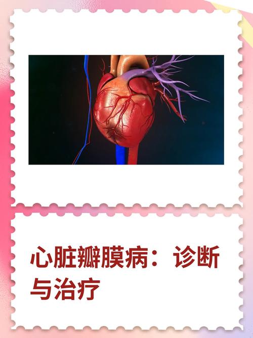 风湿性心脏瓣膜病表现