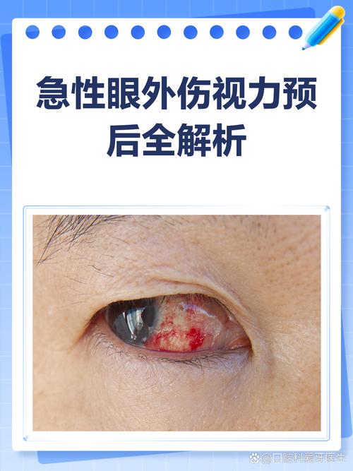 脑梗眼睛看不见 恢复