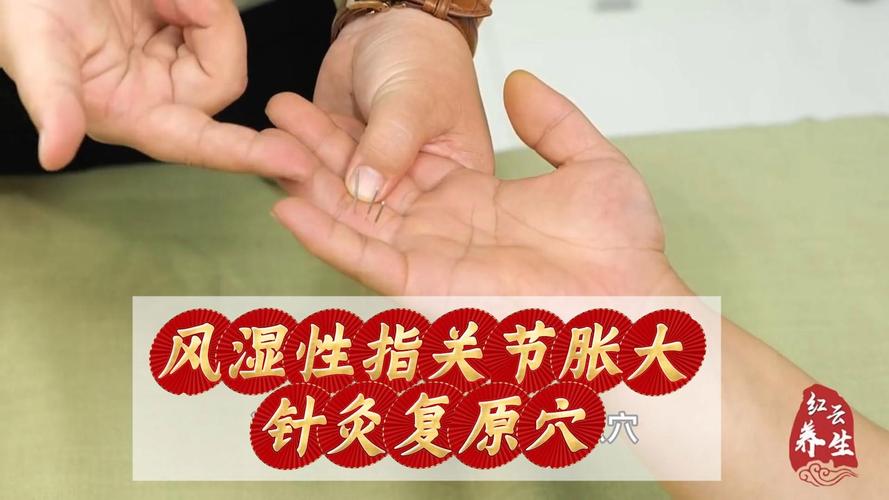 手痛风针灸哪个穴位
