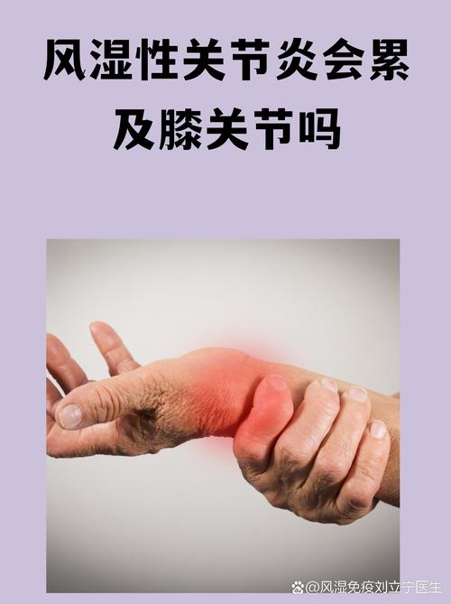 风湿病跳舞膝盖会弯吗