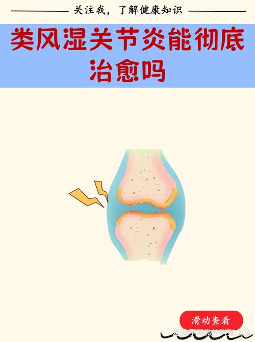 小孩风湿关节炎好治吗
