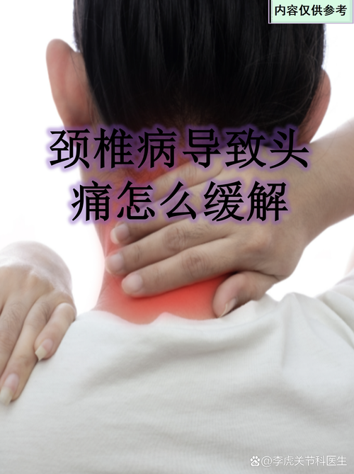 头痛脖子僵硬是脑梗吗