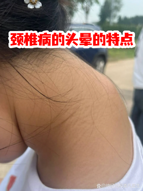 头痛脖子僵硬是脑梗吗