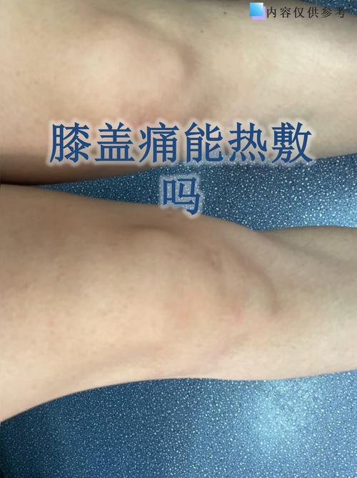 膝盖风湿痛热敷可以吗