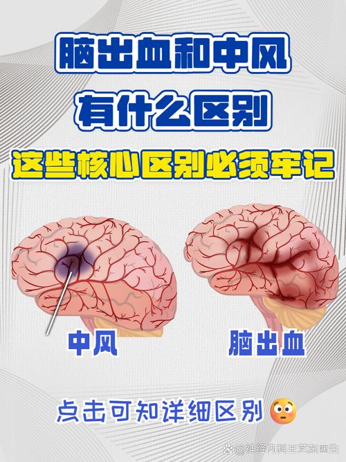 脑梗和脑出血那个严重