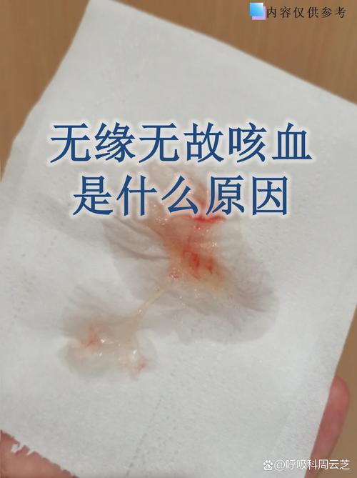 风湿性心脏病咳血治疗