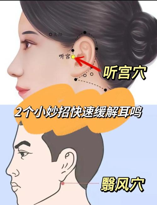 治耳聋耳呜按摩穴位