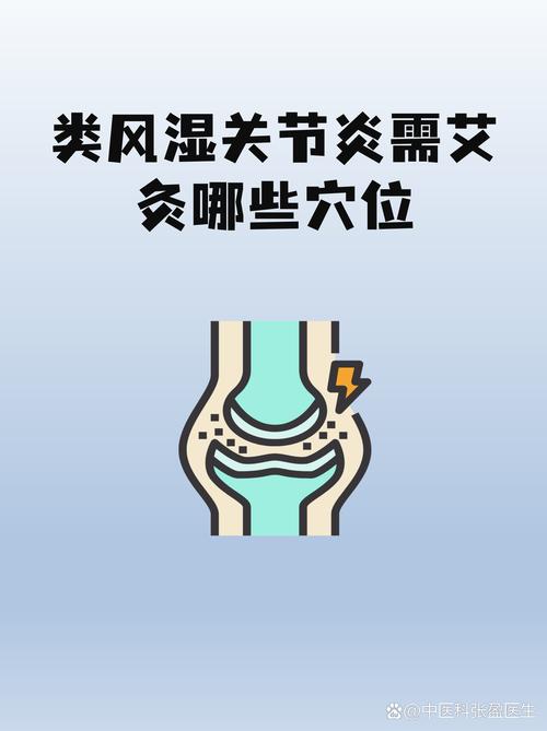 类风湿关节炎可以艾灸