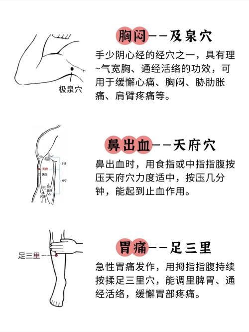 脑血栓患者穴位按摩