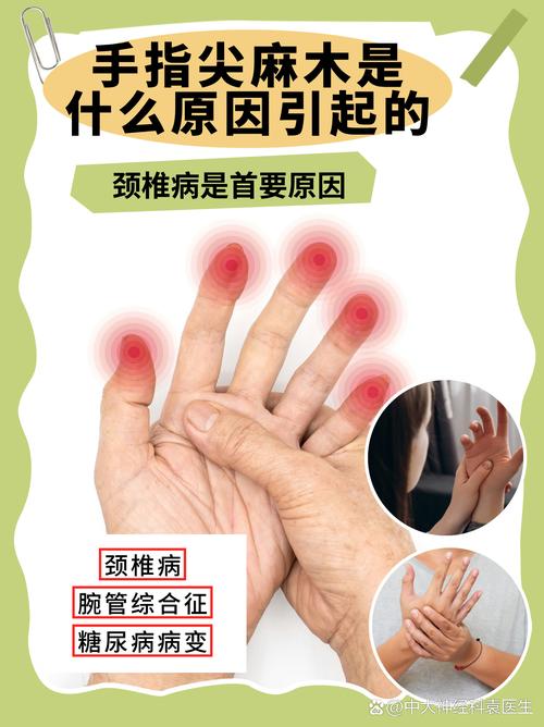 什么是风湿瘀阻颈椎病