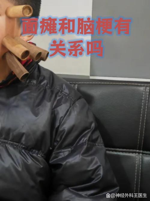 脑梗引起的面瘫能好吗