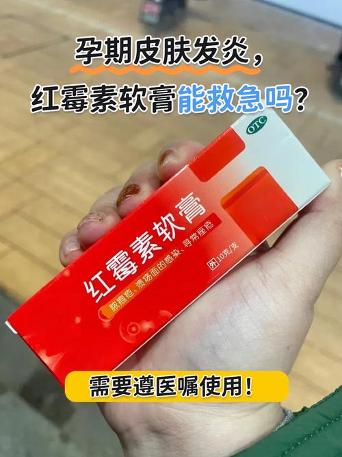 孕妇能不能闻风湿膏味