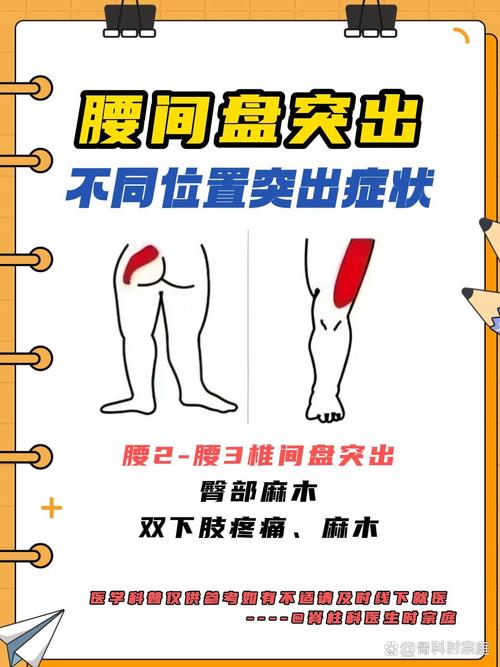 风湿和腰间盘突出区别