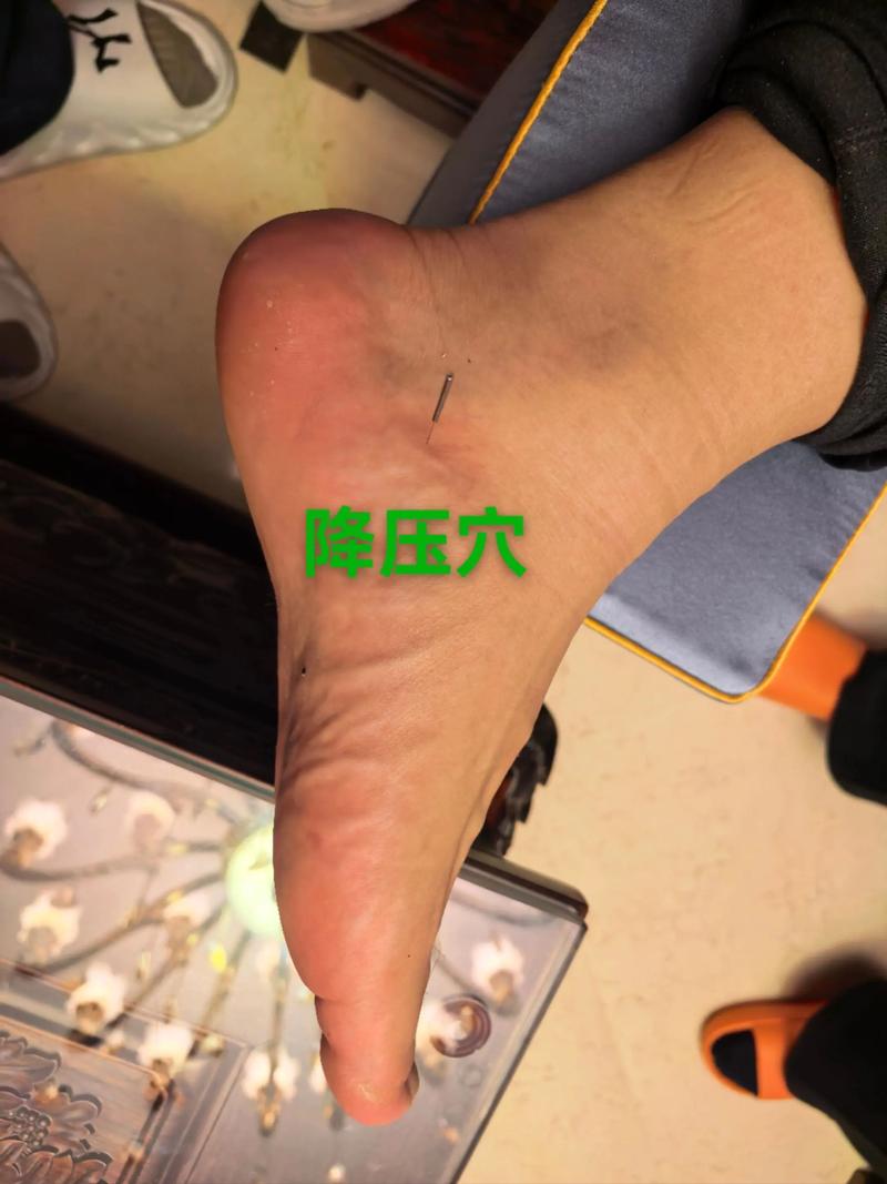 血压升高按什么穴位