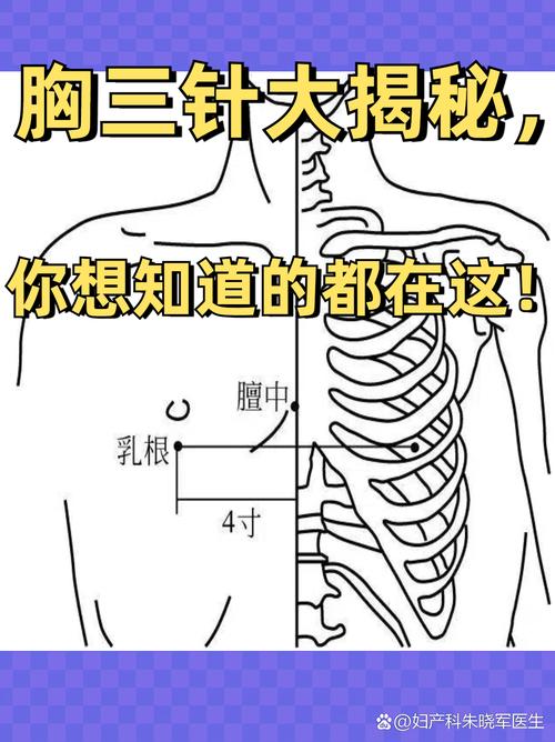 胸部腹部穴位叫什么