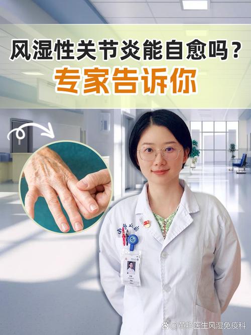 风湿病赛尔复效果怎样