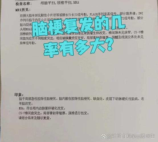 轻微脑梗复发率有多高