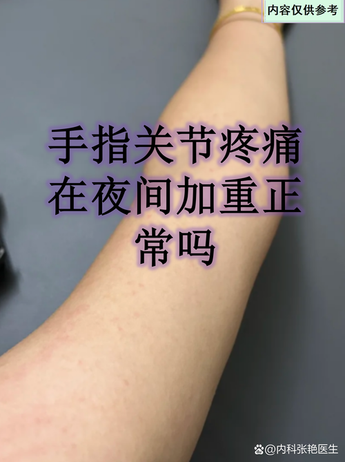 风湿疼是里面的筋疼吗