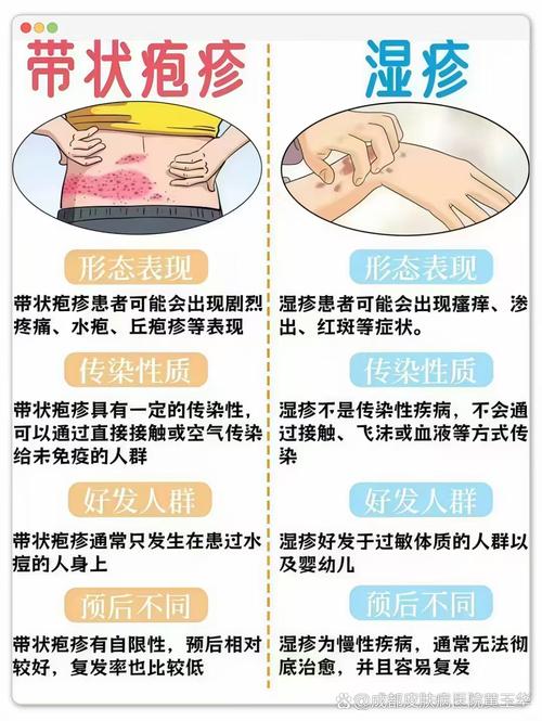 疱疹和风湿病有关系吗