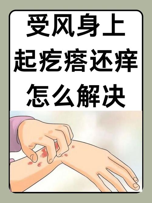 风湿疙瘩能不能自己好