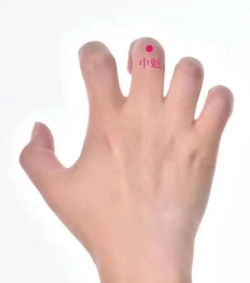 缓解孕吐按哪个穴位