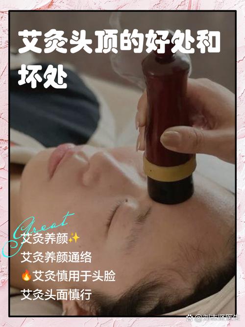 艾灸对脑梗有效果分享