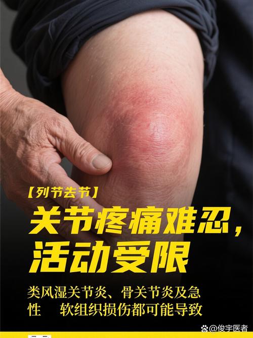 风湿关节炎痛吃什么药