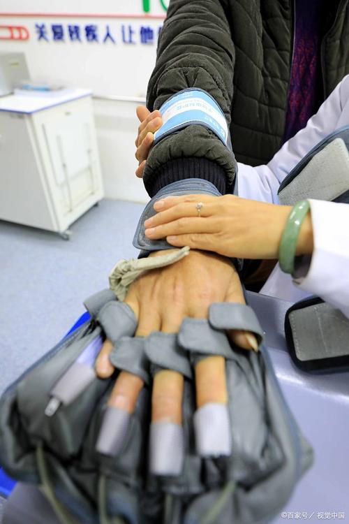 脑梗手不能动怎样恢复