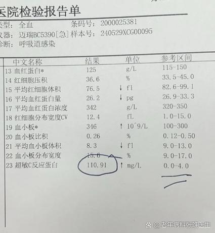 风湿四项c反应蛋白高