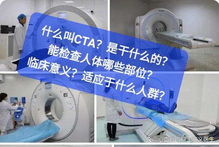 脑梗有必要做cta吗