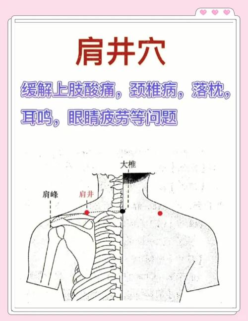 肩井穴位置附近酸痛