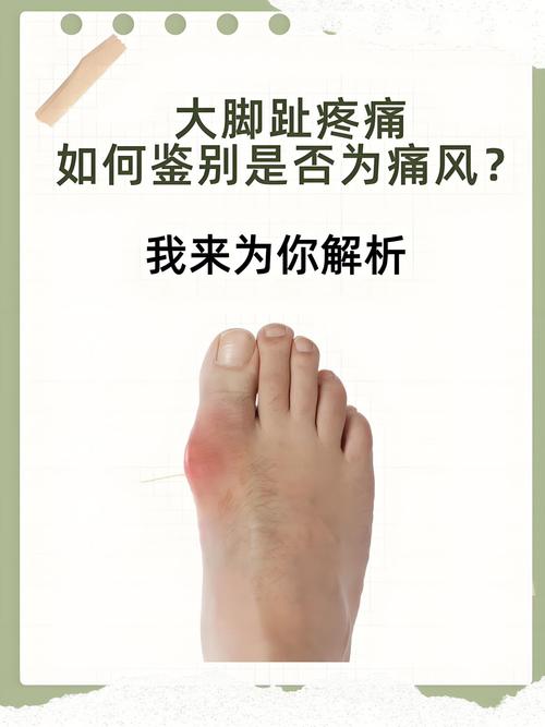 脚风湿痛是什么引起的