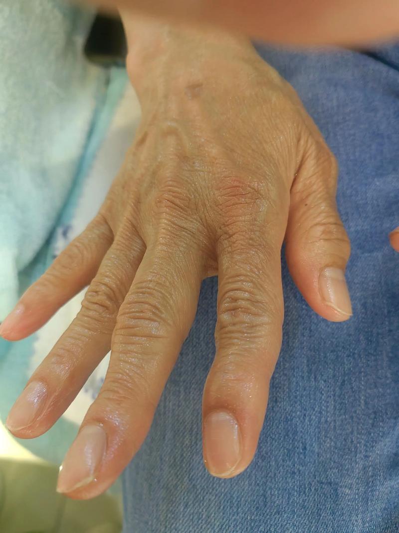 良乡医院风湿科刘爱武