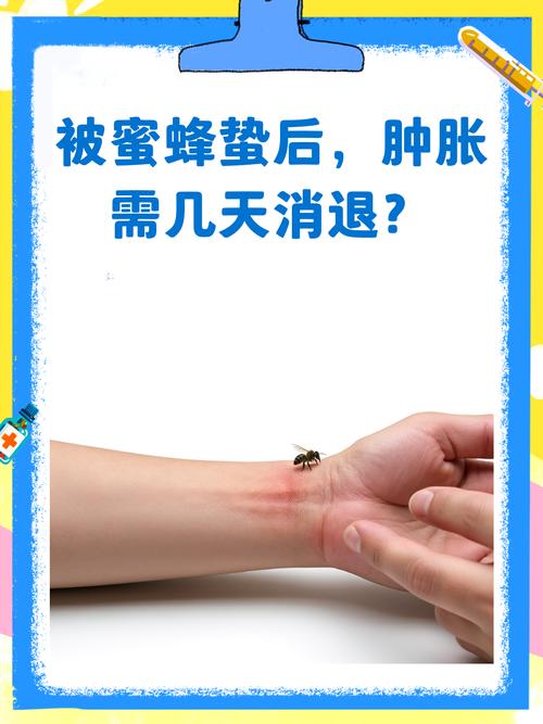 风湿病被蜜蜂蛰管用吗