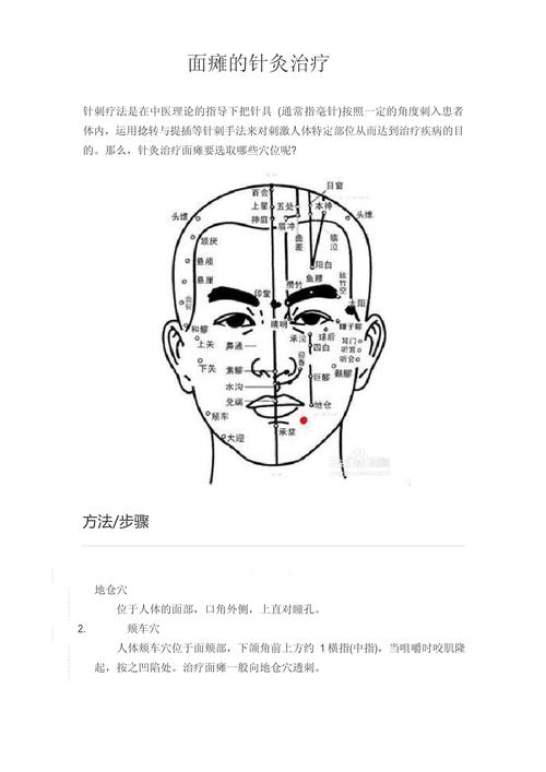 面瘫主要灸哪些穴位