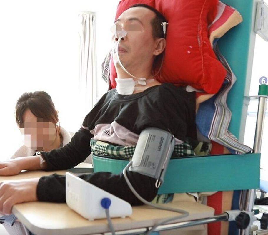 脑梗老人必须切气管吗